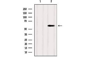 Western blot analysis of extracts from Mouse brain, using SUOX Antibody. (SUOX antibody  (Internal Region))