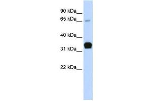 Western Blotting (WB) image for anti-Slow Skeletal Troponin T (TNNT1) antibody (ABIN2458625) (TNNT1 antibody)