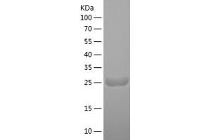 Western Blotting (WB) image for Myosin Light Chain 4, Alkali, Atrial, Embryonic (MYL4) (AA 1-197) protein (His tag) (ABIN7282682) (MYL4 Protein (AA 1-197) (His tag))