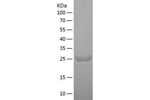 MYL4 Protein (AA 1-197) (His tag)