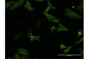 Immunofluorescence of monoclonal antibody to HKDC1 on HeLa cell. (HKDC1 antibody  (AA 102-200))