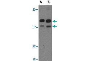 Western blot analysis of AIPL1 in rat brain tissue lysate with AIPL1 polyclonal antibody  at (A) 1 and (B) 2 ug/mL .