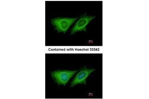 ICC/IF Image Immunofluorescence analysis of methanol-fixed HeLa, using LOC80129, antibody at 1:200 dilution. (CCDC170 antibody  (C-Term))