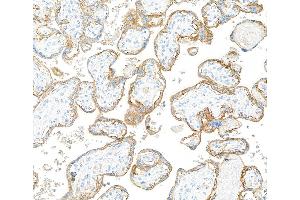 Immunohistochemistry (IHC) image for anti-Epidermal Growth Factor Receptor (EGFR) (C-Term) antibody (ABIN7795642) (Recombinant EGFR antibody  (C-Term))