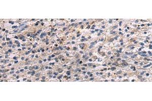 Immunohistochemistry of paraffin-embedded Human brain tissue using ANGPTL2 Polyclonal Antibody at dilution of 1:55(x200) (ANGPTL2 antibody)