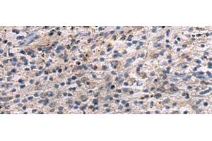 Immunohistochemistry of paraffin-embedded Human brain tissue using ANGPTL2 Polyclonal Antibody at dilution of 1:55(x200) (ANGPTL2 antibody)