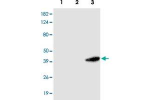 Western blot analysis of HEK 293 (1) , A - 549 (2) and HeLa (3) cells extracts were resolved by SDS - PAGE , transferred to PVDF membrane and probed with RASSF1 monoclonal antibody , clone 3F3 (1 : 1000)  .