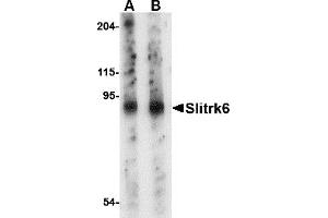 Western Blotting (WB) image for anti-SLIT and NTRK-Like Family, Member 6 (SLITRK6) (Middle Region) antibody (ABIN1031100) (SLITRK6 antibody  (Middle Region))