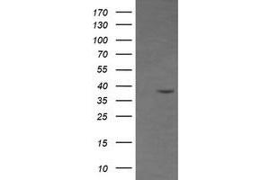 Image no. 2 for anti-CD33 (CD33) antibody (ABIN1497270) (CD33 antibody)