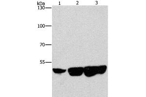 Western Blot analysis of Hela, hepG2 and 231 cell using CTBP2 Polyclonal Antibody at dilution of 1:400 (CTBP2 antibody)