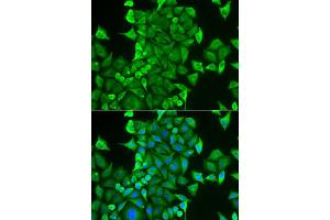 Immunofluorescence analysis of HeLa cell using CARS antibody. (CARS antibody)