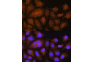 Immunofluorescence analysis of HeLa cells using GSTT2B Rabbit pAb (ABIN7267450) at dilution of 1:100. (GSTT2B antibody  (AA 115-244))
