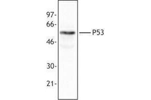 Western Blotting (WB) image for anti-Tumor Protein P53 (TP53) antibody (ABIN2664004) (p53 antibody)