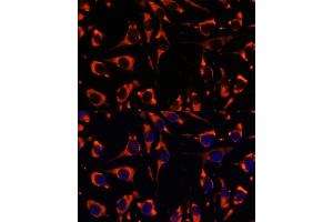 Immunofluorescence analysis of L929 cells using INPP5E antibody (ABIN7267883) at dilution of 1:100. (INPP5E antibody  (AA 510-630))