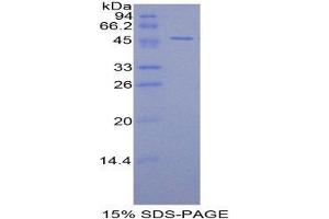 SDS-PAGE (SDS) image for alpha 1 Microglobulin/bikunin precursor (AMBP) (AA 20-202) protein (His tag,GST tag) (ABIN2122379) (AMBP Protein (AA 20-202) (His tag,GST tag))