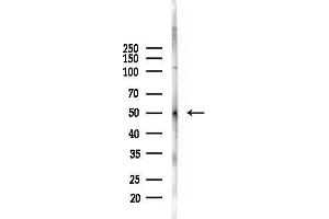 anti-Chordin-Like 1 (CHRDL1) antibody