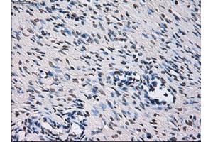 Immunohistochemical staining of paraffin-embedded colon tissue using anti-ID3mouse monoclonal antibody. (ID3 antibody)