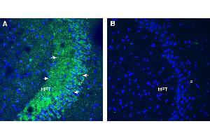 Expression of Opsin 3 in mouse hippocampus.