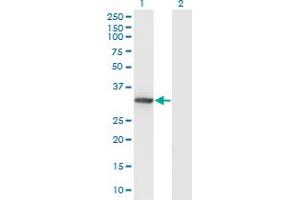 Western Blot analysis of DNALI1 expression in transfected 293T cell line by DNALI1 monoclonal antibody (M04A), clone 2H3. (DNALI1 antibody  (AA 1-258))