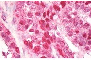 Anti-CNOT4 / CLONE243 antibody IHC staining of human prostate. (CNOT4 antibody  (AA 50-100))