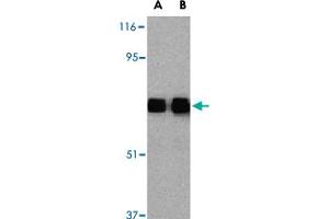 Western blot analysis of TLR10 in human lymph node tissue lysates with TLR10 polyclonal antibody  at (A) 0. (TLR10 antibody  (Internal Region))