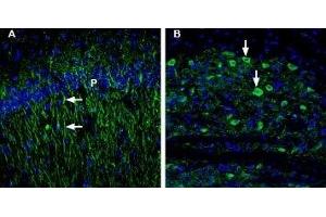 Expression of 5-Hydroxytryptamine receptor 1B in rat and mouse brain - Immunohistochemical staining of rat and mouse brain sections using Anti-5HT1B Receptor (HTR1B) (extracellular) Antibody (ABIN7043616, ABIN7045280 and ABIN7045281), (1:200). (5HT1B Receptor antibody  (Extracellular, N-Term))