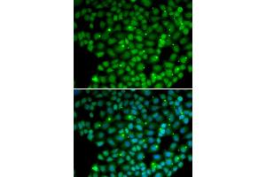 Immunofluorescence analysis of U2OS cells using MUTYH antibody (ABIN5970784).