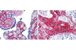 抗VI型胶原抗体（600-401-108 Lot 26009，1:400 45 min RT）在人胎盘的FFPE切片（左）中呈强染色，基质和细胞外间隙呈红色，睾丸（右）中呈生精小管间细胞外间隙染色。（COL6抗体）