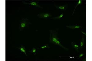 Immunofluorescence of monoclonal antibody to RPL7 on HeLa cell. (RPL7 antibody  (AA 158-248))