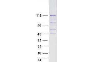 Validation with Western Blot