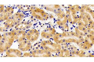 Detection of HADH in Mouse Kidney Tissue using Polyclonal Antibody to Hydroxyacyl Coenzyme A Dehydrogenase (HADH) (HADH antibody  (AA 1-167))