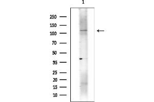 Western blot analysis of lysates from COLO205 cells(heat-shock treatment), using MORC3 Antibody at 1/1000 dilution.