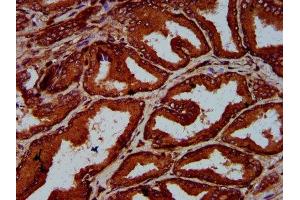IHC image of ABIN7151584 diluted at 1:600 and staining in paraffin-embedded human prostate tissue performed on a Leica BondTM system. (ELP4 antibody  (AA 117-223))