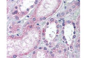 Immunohistochemical (Formalin/PFA-fixed paraffin-embedded sections) staining in human kidney with AADAT polyclonal antibody . (AADAT antibody)