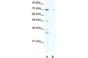Human HepG2; WB Suggested Anti-ZNF37A Antibody Titration: 1.
