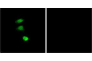 Immunofluorescence analysis of COS7 cells, using IRS-1 (Phospho-Ser307) Antibody.