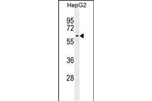 Western blot analysis in HepG2 cell line lysates (35ug/lane). (PPARD antibody  (C-Term))
