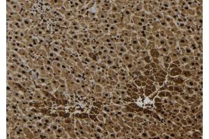 ABIN6277063 at 1/100 staining Mouse liver tissue by IHC-P. (FGFR1 antibody  (C-Term))