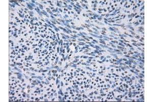 Image no. 8 for anti-Fc gamma RII (CD32) antibody (ABIN1497255) (Fc gamma RII (CD32) antibody)