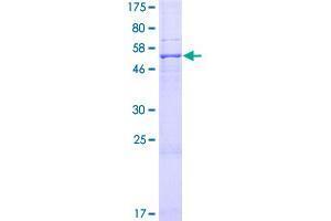 Image no. 1 for Sideroflexin 2 (SFXN2) (AA 1-322) protein (GST tag) (ABIN1319786) (SFXN2 Protein (AA 1-322) (GST tag))