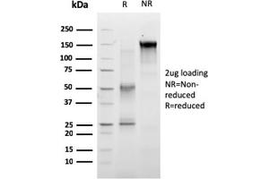 SDS-PAGE Analysis of Purified RET Mouse Monoclonal Antibody (RET/2663). (Ret Proto-Oncogene antibody  (AA 702-848))