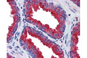 Immunohistochemistry (IHC) image for anti-Klotho (KL) (Middle Region) antibody (ABIN2776875) (Klotho antibody  (Middle Region))