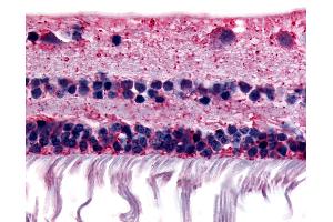 Anti-RGR antibody IHC of human retina. (RGR antibody  (Extracellular Domain))