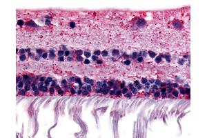 Anti-RGR antibody IHC of human retina. (RGR antibody  (Extracellular Domain))