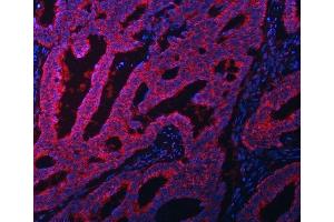 anti-Eukaryotic Translation Initiation Factor 3 Subunit A (EIF3A) (AA 13-477) antibody