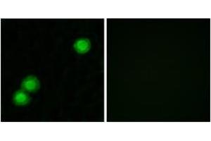 Immunofluorescence analysis of MCF7 cells, using IPKB Antibody. (PKIB antibody  (AA 29-78))