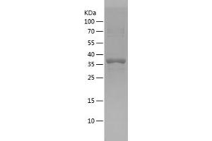 Western Blotting (WB) image for Growth Differentiation Factor 1 (GDF1) (AA 254-372) protein (His-IF2DI Tag) (ABIN7281866) (GDF1 Protein (AA 254-372) (His-IF2DI Tag))