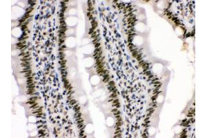 Anti- HMG4 Picoband antibody, IHC(P) IHC(P): Rat Intestine Tissue (HMGB3 antibody  (N-Term))