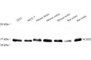 Western blot analysis of NCBP2 (ABIN7074870) at dilution of 1: 300 (NCBP2 antibody)