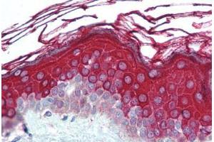 Human Skin (formalin-fixed, paraffin-embedded) stained with ALAS1 antibody ABIN290712 at 5 ug/ml followed by biotinylated goat anti-rabbit IgG secondary antibody ABIN481713, alkaline phosphatase-streptavidin and chromogen. (ALAS1 antibody  (AA 480-530))